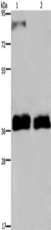Gel: 8%SDS-PAGE, Lysate: 40 ug, Lane 1-2: 231 cells, A172 cells, Primary antibody: CSB-PA218023(FETUB Antibody) at dilution 1/700, Secondary antibody: Goat anti rabbit IgG at 1/8000 dilution, Exposure time: 2 minutes