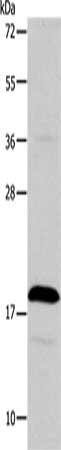 Gel: 10+12+15%SDS-PAGE, Lysate: 40 ug, Lane: Jurkat cells, Primary antibody: CSB-PA218260(TSLP Antibody) at dilution 1/850, Secondary antibody: Goat anti rabbit IgG at 1/8000 dilution, Exposure time: 2 minutes