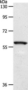 Gel: 10%SDS-PAGE Lysates (from left to right): Mouse eye tissue Amount of lysate: 40ug per lane Primary antibody: 1/1100 dilution Secondary antibody dilution: 1/8000 Exposure time: 2 seconds