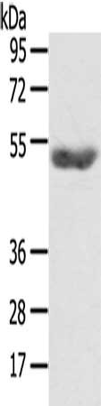 Gel: 8%SDS-PAGE, Lysate: 40 ug, Lane: Mouse plasma tissue, Primary antibody: CSB-PA218593(AGPAT6 Antibody) at dilution 1/400, Secondary antibody: Goat anti rabbit IgG at 1/8000 dilution, Exposure time: 5 minutes