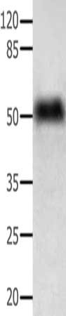 Gel: 10+12%SDS-PAGE, Lysate: 40 ug, Lane: Human lymphoma tissue, Primary antibody: CSB-PA218620(ACTG1 Antibody) at dilution 1/350, Secondary antibody: Goat anti rabbit IgG at 1/8000 dilution, Exposure time: 1 second