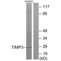 Western blot analysis of extracts from HUVEC cells, using TIMP3 antibody.