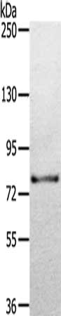 Gel: 6%SDS-PAGE, Lysate: 40 ug, Lane: Mouse eyes tissue, Primary antibody: CSB-PA219322(TGM7 Antibody) at dilution 1/300, Secondary antibody: Goat anti rabbit IgG at 1/8000 dilution, Exposure time: 5 seconds