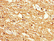 Immunohistochemistry of paraffin-embedded human brain tissue using CSB-PA21939A0Rb at dilution of 1:100