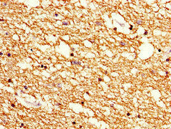 Immunohistochemistry of paraffin-embedded human brain tissue using CSB-PA21939A0Rb at dilution of 1:100