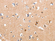 The image on the left is immunohistochemistry of paraffin-embedded Human brain tissue using CSB-PA219431(RALB Antibody) at dilution 1/10, on the right is treated with synthetic peptide. (Original magnification: ×200)