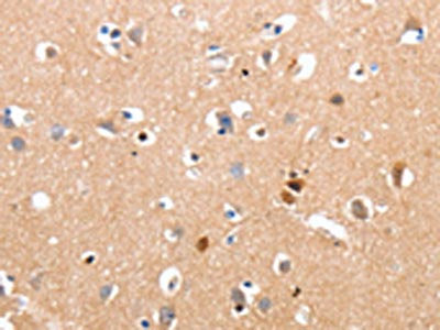 The image on the left is immunohistochemistry of paraffin-embedded Human brain tissue using CSB-PA219431(RALB Antibody) at dilution 1/10, on the right is treated with synthetic peptide. (Original magnification: ×200)