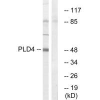 Western blot analysis of extracts from Jurkat cells, using PLD4 antibody.