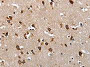 The image on the left is immunohistochemistry of paraffin-embedded Human brain tissue using CSB-PA219638(LAMA1 Antibody) at dilution 1/70, on the right is treated with synthetic peptide. (Original magnification: ×200)