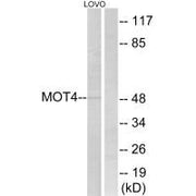 Western blot analysis of extracts from LOVO cells, using MOT4 antibody.