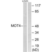 Western blot analysis of extracts from LOVO cells, using MOT4 antibody.