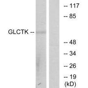 Western blot analysis of extracts from 3T3 cells, using GLCTK antibody.