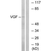 Western blot analysis of extracts from RAW264.7 cells, using VGF antibody.
