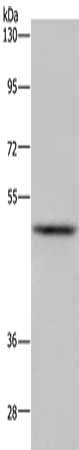 Gel: 8%SDS-PAGE, Lysate: 40 ug, Lane: Mouse lung tissue, Primary antibody: CSB-PA220104(IRF4 Antibody) at dilution 1/300, Secondary antibody: Goat anti rabbit IgG at 1/8000 dilution, Exposure time: 2 minutes