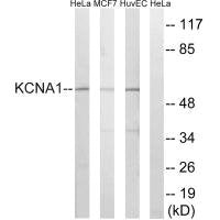 Western blot analysis of extracts from HeLa cells, MCF-7 cells and HuvEc cells, using KCNA1 antibody.