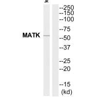 Western blot analysis of extracts from Jurkat cells, using MATK antibody.