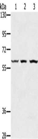 Gel: 6%SDS-PAGE, Lysate: 40 ug, Lane 1-3: Human breast infiltrative duct tissue, Jurkat cells, HT29 cells, Primary antibody: CSB-PA220770(OXSR1 Antibody) at dilution 1/300, Secondary antibody: Goat anti rabbit IgG at 1/8000 dilution, Exposure time...
