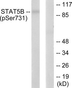 Western blot analysis of extracts from RAW264.7 cells, treated with EGF (200ng/ml, 30mins), using STAT5B (phospho-Ser731) antibody. The lane on the right is treated with the synthesized peptide.