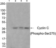 Western blot analysis of extracts from 3T3 cells (Lane 2), A549 cells (Lane 3) and Hela cells (Lane 4), using Cyclin C (Phospho-Ser275) Antibody. The lane on the left is treated with antigen-specific peptide.