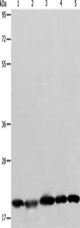 Gel: 8+12%SDS-PAGE, Lysate: 40 ug, Lane 1-5: Human brain malignant glioma tissue, MCF7 cells, Raji cells, Lovo cells, 293T cells, Primary antibody: CSB-PA221042(BAX Antibody) at dilution 1/426, Secondary antibody: Goat anti rabbit IgG at 1/8000 di...