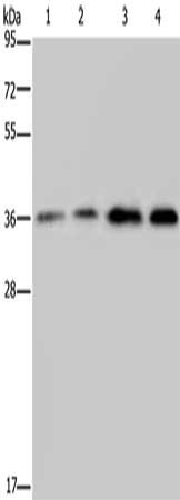 Gel: 10%SDS-PAGE, Lysate: 40 ug, Lane 1-4: Hela cells, Jurkat cells, human testis tissue, 231 cells, Primary antibody: CSB-PA221218(OCIAD1 Antibody) at dilution 1/200, Secondary antibody: Goat anti rabbit IgG at 1/8000 dilution, Exposure time: 30...