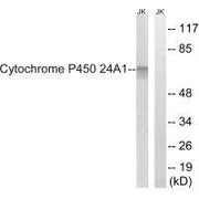 Western blot analysis of extracts from HUVEC cells, using Cytochrome P450 24A1 antibody.