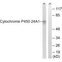Western blot analysis of extracts from HUVEC cells, using Cytochrome P450 24A1 antibody.