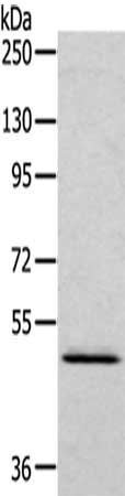 Gel: 6%SDS-PAGE,Lysate: 40 ug,,Primary antibody: CSB-PA222017(RCC1 Antibody) at dilution 1/200 dilution,Secondary antibody: Goat anti rabbit IgG at 1/8000 dilution,Exposure time: 2 minutes