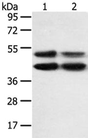 Gel: 8%SDS-PAGE, Lysate: 40 ug, Lane 1-2: K562 and hela cell, Primary antibody: CSB-PA222139(MAPK8 Antibody) at dilution 1/600 dilution, Secondary antibody: Goat anti rabbit IgG at 1/8000 dilution, Exposure time: 10 seconds