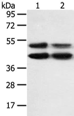 Gel: 8%SDS-PAGE, Lysate: 40 ug, Lane 1-2: K562 and hela cell, Primary antibody: CSB-PA222139(MAPK8 Antibody) at dilution 1/600 dilution, Secondary antibody: Goat anti rabbit IgG at 1/8000 dilution, Exposure time: 10 seconds
