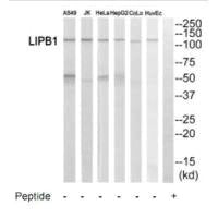 Western blot analysis of extracts from A549 cells, Jurkat cells, HeLa cells, HepG2 cells, COLO205 cells and HuvEc cells, using LIPB1 antibody.