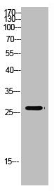 Western Blot analysis of mouse-kidney cells using Antibody diluted at 500. Secondary antibody was diluted at 1:20000