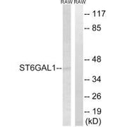 Western blot analysis of extracts from RAW264.7 cells, using ST6GAL1 antibody.