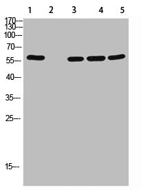 Western Blot analysis of 1,mouse-lung 2,mouse-spleen 3,mouse-kidney 4,mouse-heart 5,293 cells using primary antibody diluted at 1:500(4°C overnight). Secondary antibody:Goat Anti-rabbit IgG IRDye 800( diluted at 1:5000, 25°C, 1 hour)