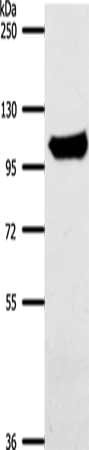 Gel: 8%SDS-PAGE, Lysate: 40 ug, Lane: Mouse liver tissue, Primary antibody: CSB-PA223057(ACO1 Antibody) at dilution 1/700, Secondary antibody: Goat anti rabbit IgG at 1/8000 dilution, Exposure time: 10 seconds