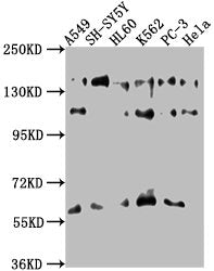 Western Blot Positive WB detected in: A549 whole cell lysate, SH-SY5Y whole cell lysate, HL60 whole cell lysate, K562 whole cell lysate, PC-3 whole cell lysate, Hela whole cell lysate All lanes: SOS2 antibody at 1:1000 Secondary Goat polyclonal to...