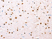 The image on the left is immunohistochemistry of paraffin-embedded Human brain tissue using CSB-PA223323(ESR1 Antibody) at dilution 1/76, on the right is treated with synthetic peptide. (Original magnification: ×200)