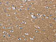 The image on the left is immunohistochemistry of paraffin-embedded Human brain tissue using CSB-PA223691(GPM6A Antibody) at dilution 1/50, on the right is treated with fusion protein. (Original magnification: ×200)