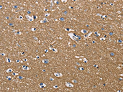 The image on the left is immunohistochemistry of paraffin-embedded Human brain tissue using CSB-PA223691(GPM6A Antibody) at dilution 1/50, on the right is treated with fusion protein. (Original magnification: ×200)