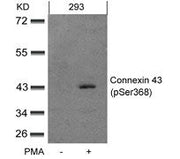 Western blot analysis of extracts from 293 cells untreated or treated with PMA using Connexin 43(phospho-Ser368) Antibody.