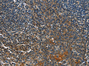 The image on the left is immunohistochemistry of paraffin-embedded Human tonsil tissue using CSB-PA224156(CACNB1 Antibody) at dilution 1/50, on the right is treated with fusion protein. (Original magnification: ×200)