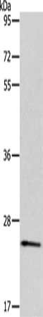 Gel: 10%SDS-PAGE, Lysate: 40 ug, Lane: Mouse trachea tissue, Primary antibody: CSB-PA224357(PPAP2C Antibody) at dilution 1/600, Secondary antibody: Goat anti rabbit IgG at 1/8000 dilution, Exposure time: 20 seconds