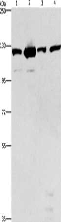 Gel: 6%SDS-PAGE, Lysate: 40 ug, Lane 1-4: 231 cells, NIH/3T3 cells, A431 cells, hela cells, Primary antibody: CSB-PA224427(PTK2 Antibody) at dilution 1/300, Secondary antibody: Goat anti rabbit IgG at 1/8000 dilution, Exposure time: 40 seconds