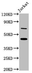 Western Blot Positive WB detected in: Jurkat whole cell lysate All lanes: ERI1 antibody at 7ug/ml Secondary Goat polyclonal to rabbit IgG at 1/50000 dilution Predicted band size: 41 kDa Observed band size: 46 kDa