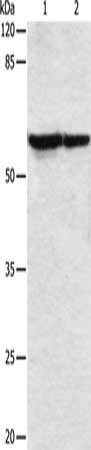 Gel: 8%SDS-PAGE, Lysate: 30 ug, Lane 1-2: Hela cells, 293T cells, Primary antibody: CSB-PA224594(VIM Antibody) at dilution 1/250, Secondary antibody: Goat anti rabbit IgG at 1/8000 dilution, Exposure time: 30 seconds