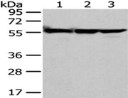 Gel: 8%SDS-PAGE, Lysate: 40 ug, Lane 1-3: A549, hela and 293T cell, Primary antibody: CSB-PA225018(FYN Antibody) at dilution 1/200 dilution, Secondary antibody: Goat anti rabbit IgG at 1/8000 dilution, Exposure time: 10 seconds