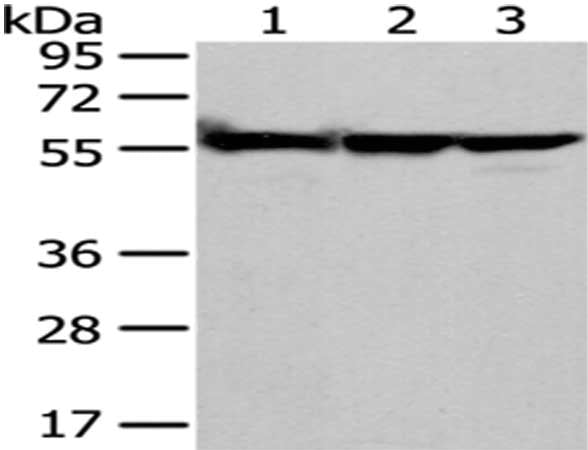 Gel: 8%SDS-PAGE, Lysate: 40 ug, Lane 1-3: A549, hela and 293T cell, Primary antibody: CSB-PA225018(FYN Antibody) at dilution 1/200 dilution, Secondary antibody: Goat anti rabbit IgG at 1/8000 dilution, Exposure time: 10 seconds