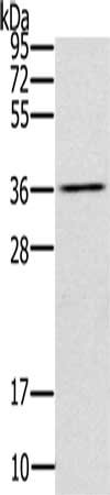 Gel: 10%SDS-PAGE, Lysate: 40 ug, Lane: Mouse liver tissue, Primary antibody: CSB-PA225237(UBXN2A Antibody) at dilution 1/200, Secondary antibody: Goat anti rabbit IgG at 1/8000 dilution, Exposure time: 10 seconds