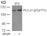 Western blot analysis of extracts from 3T3 cells untreated or treated with serum using PLC-g1(phospho-Tyr771) Antibody.