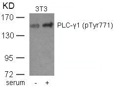 Western blot analysis of extracts from 3T3 cells untreated or treated with serum using PLC-g1(phospho-Tyr771) Antibody.